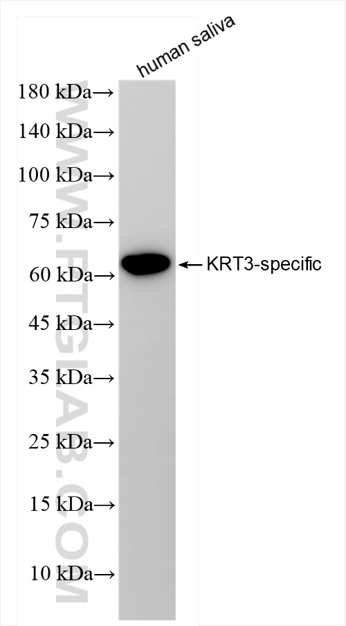 WB analysis of human saliva using 84042-1-RR