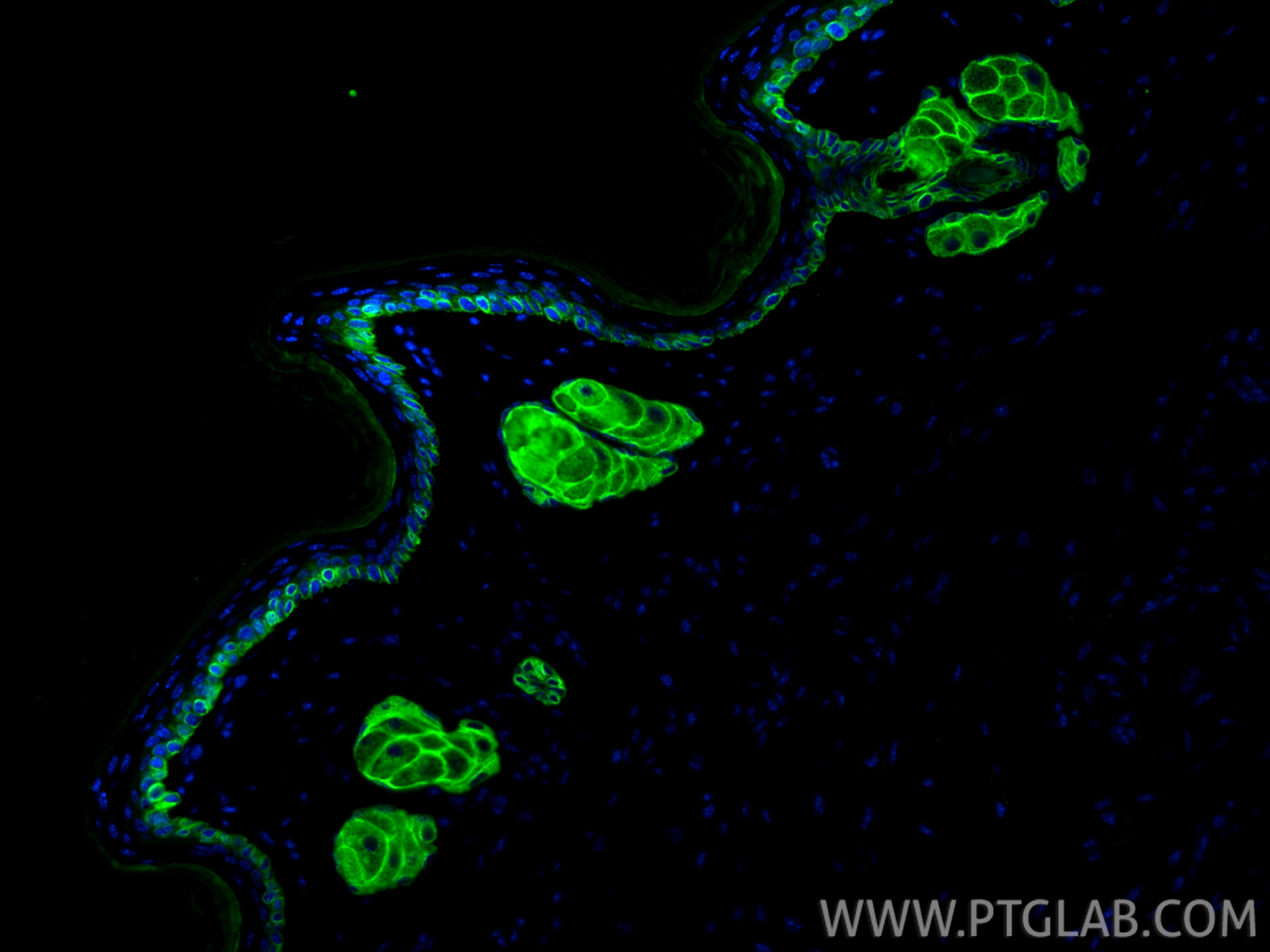 IF Staining of mouse skin using 86277-2-RR