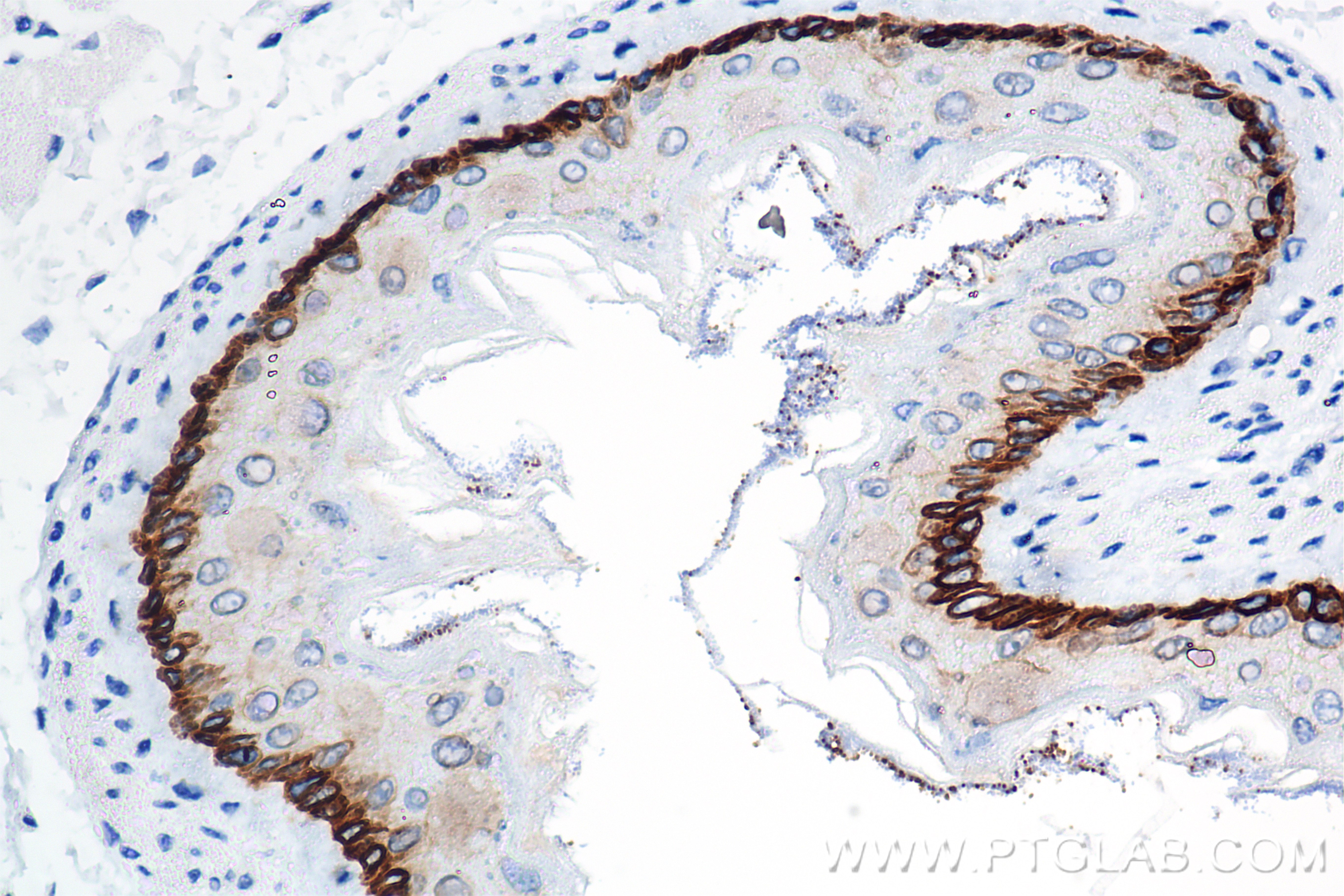 IHC staining of mouse esophagus using 86277-2-RR