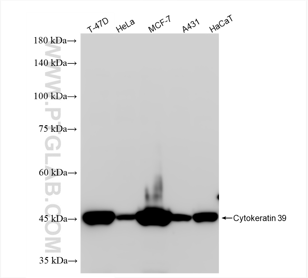 WB analysis using 86277-2-RR