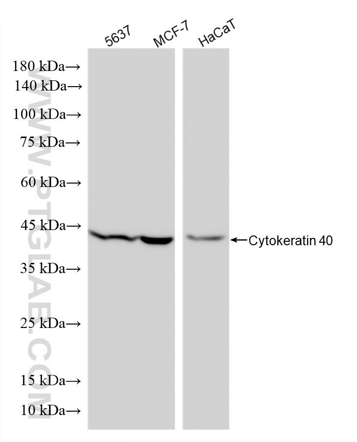 WB analysis using 86531-2-RR