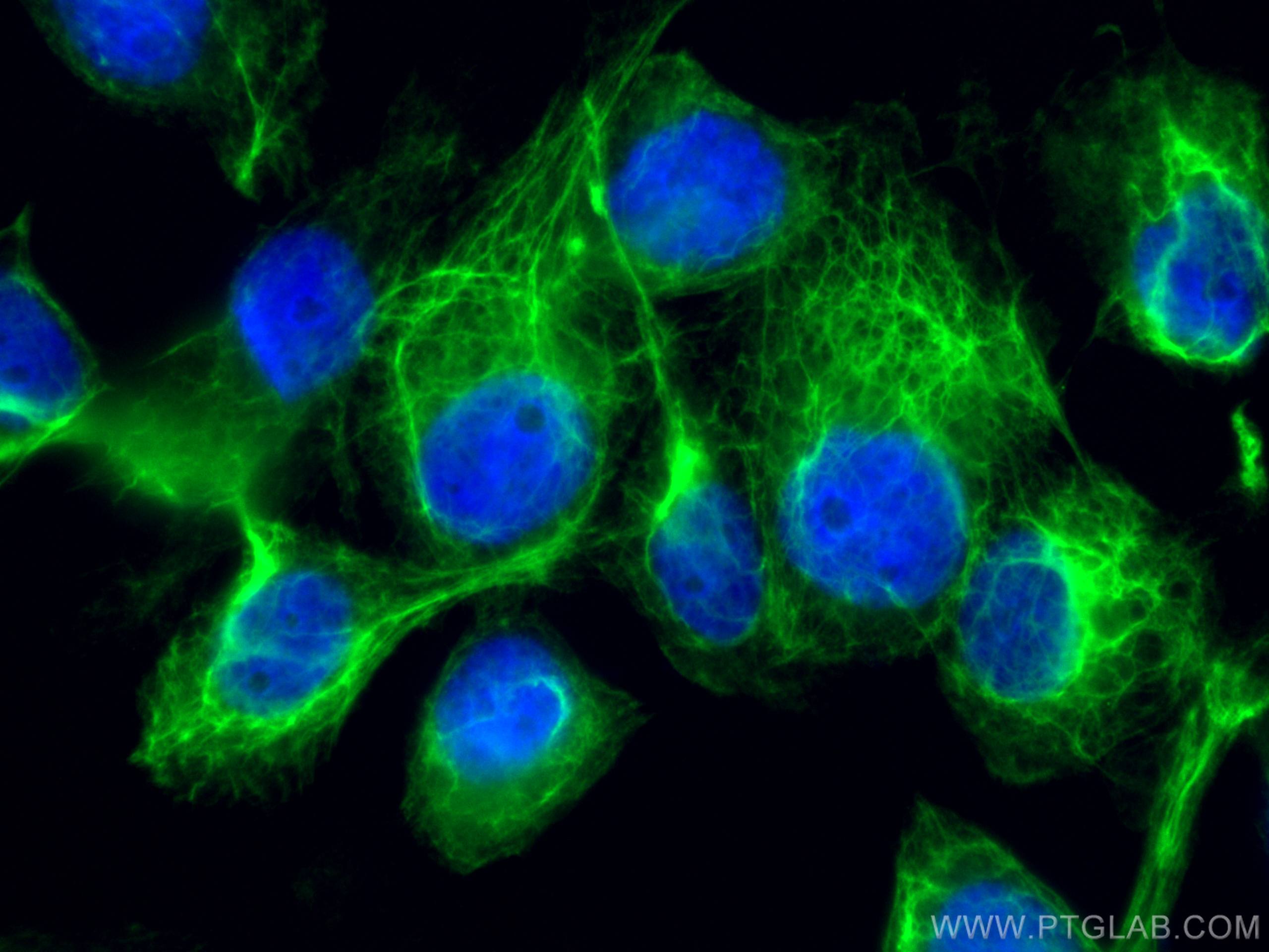 Cytokeratin 5