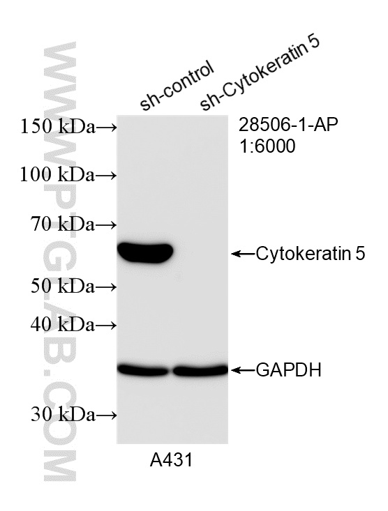 WB analysis of A431 using 28506-1-AP WB analysis of A431 using 28506-1-AP