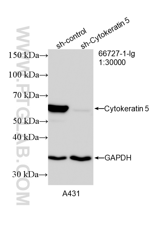 WB analysis of A431 using 66727-1-Ig