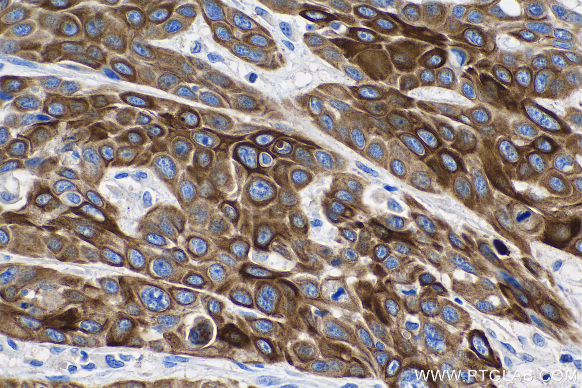 Cytokeratin 6A