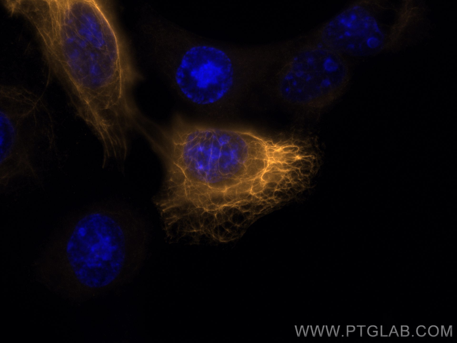 Cytokeratin 6A