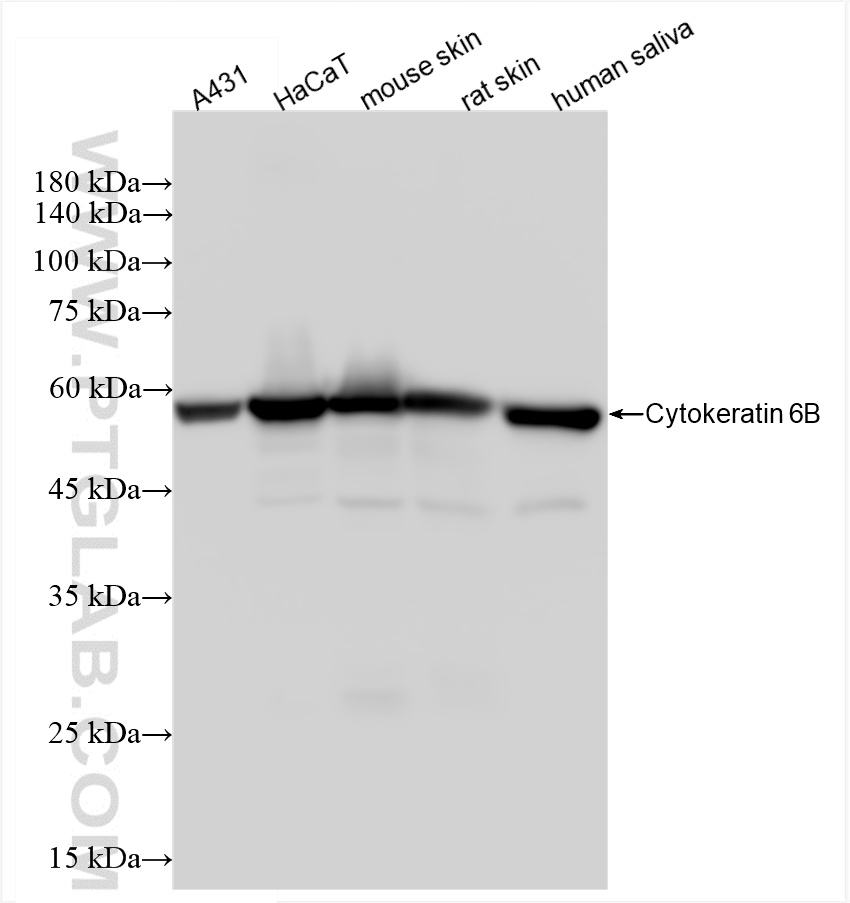 WB analysis using 85423-2-RR (same clone as 85423-2-PBS)