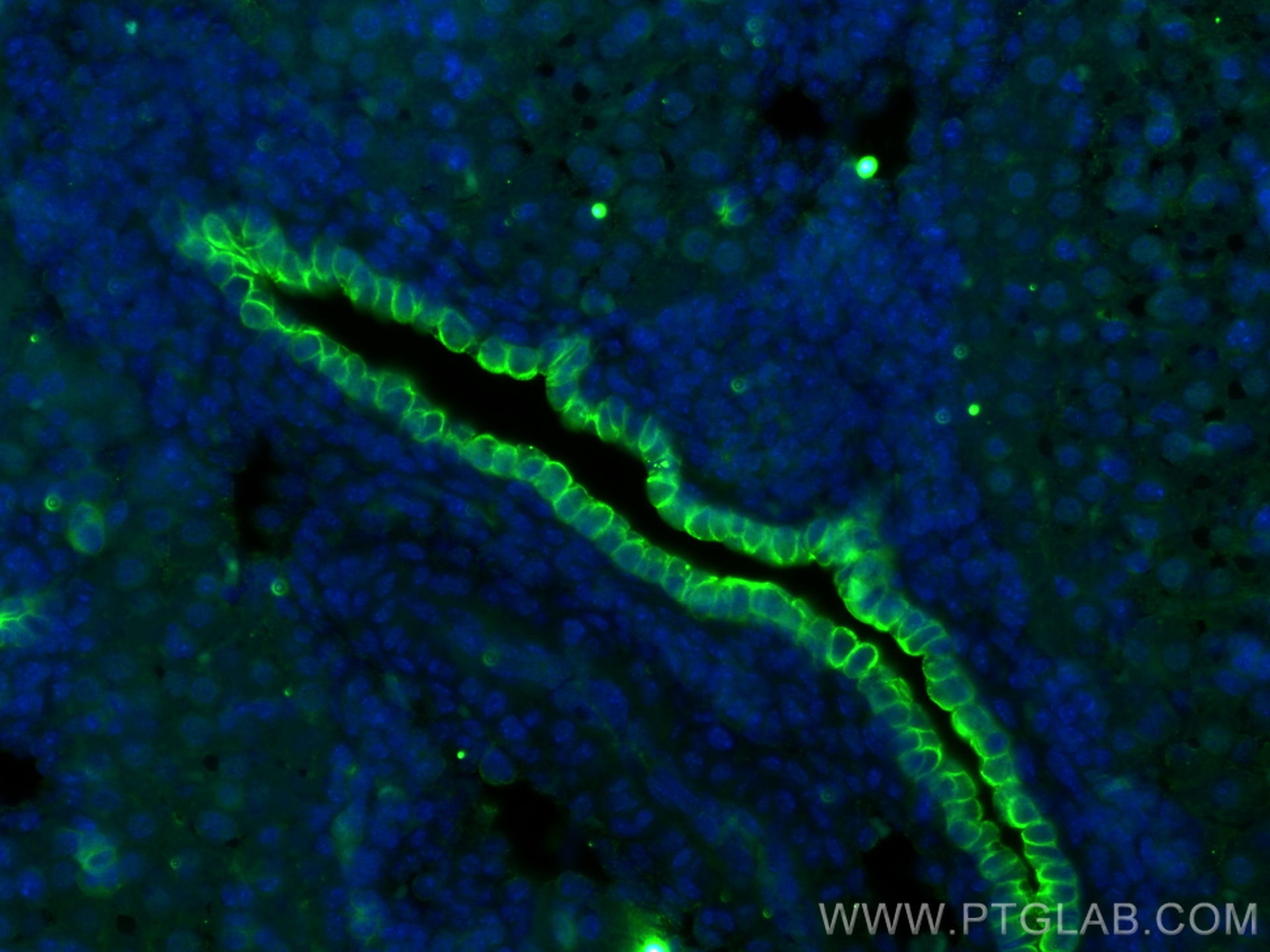 IF Staining of mouse liver using 68296-1-Ig