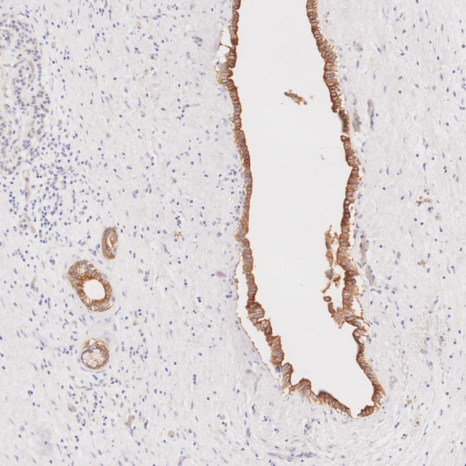 IHC staining of human pancreas using 68296-1-Ig