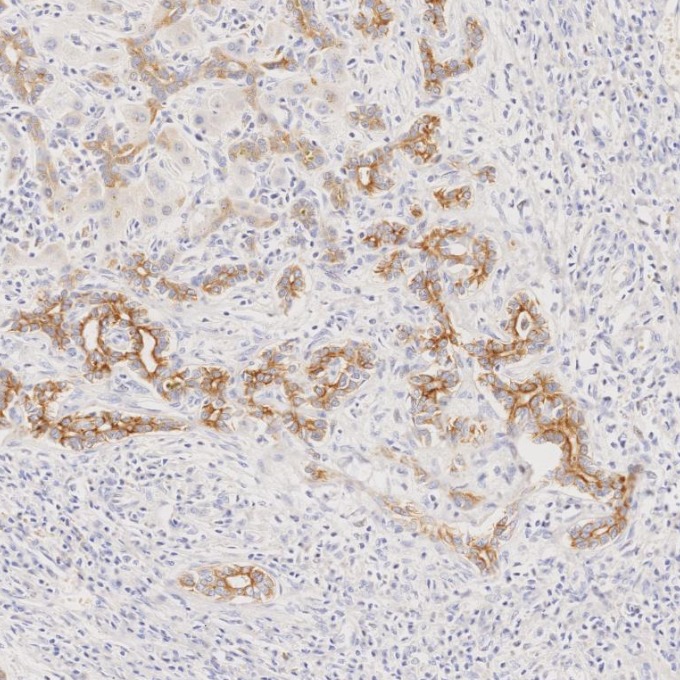 IHC staining of human liver using 68296-1-Ig