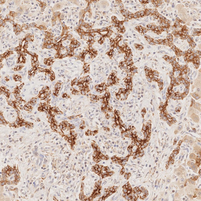 IHC staining of human liver using 68296-1-Ig