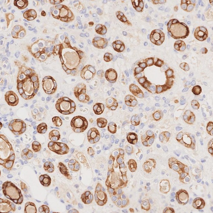 IHC staining of human kidney using 68296-1-Ig