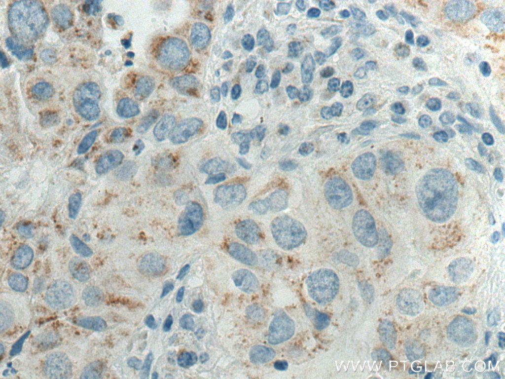 Cytokeratin 7