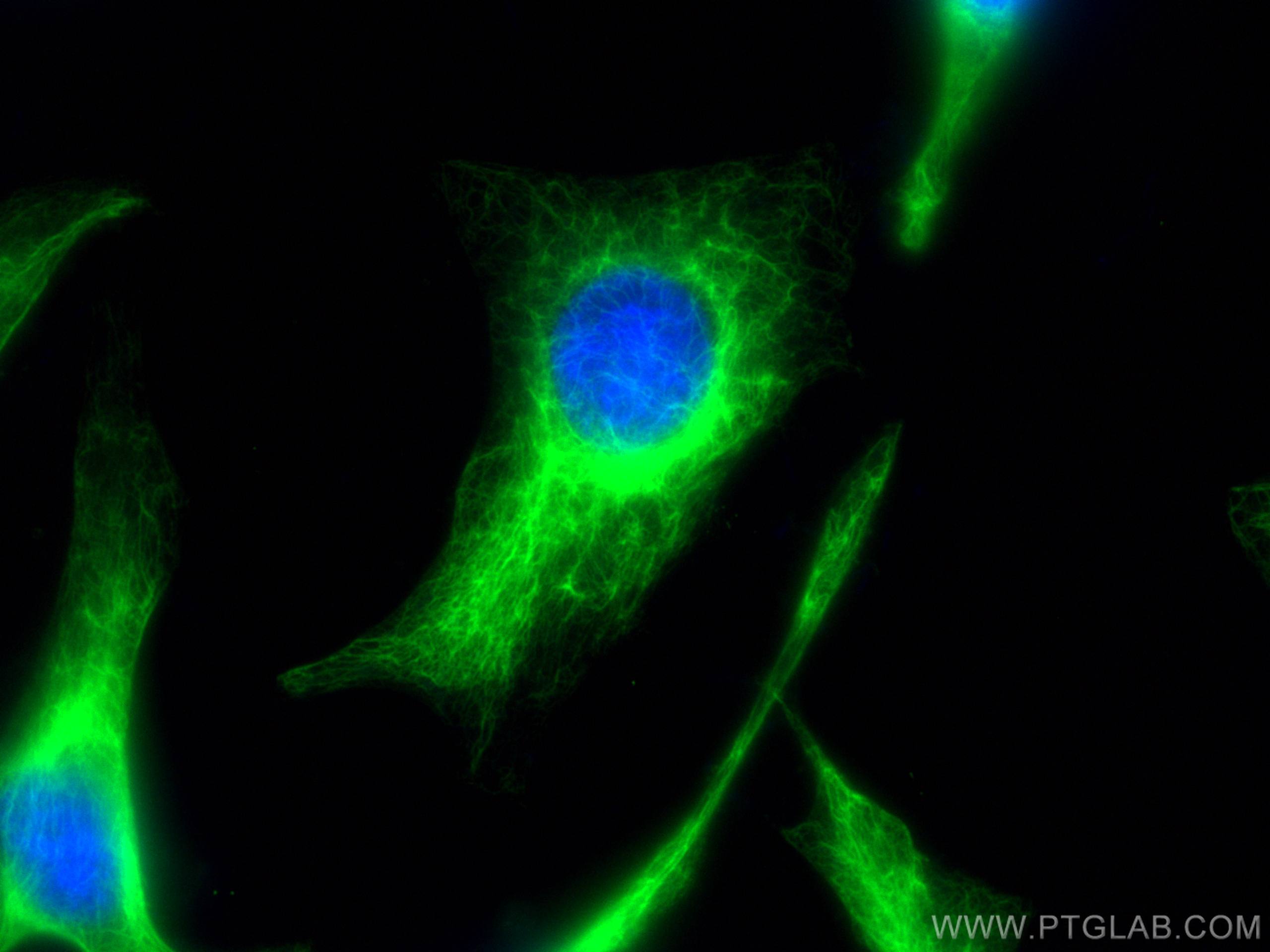 Cytokeratin 7