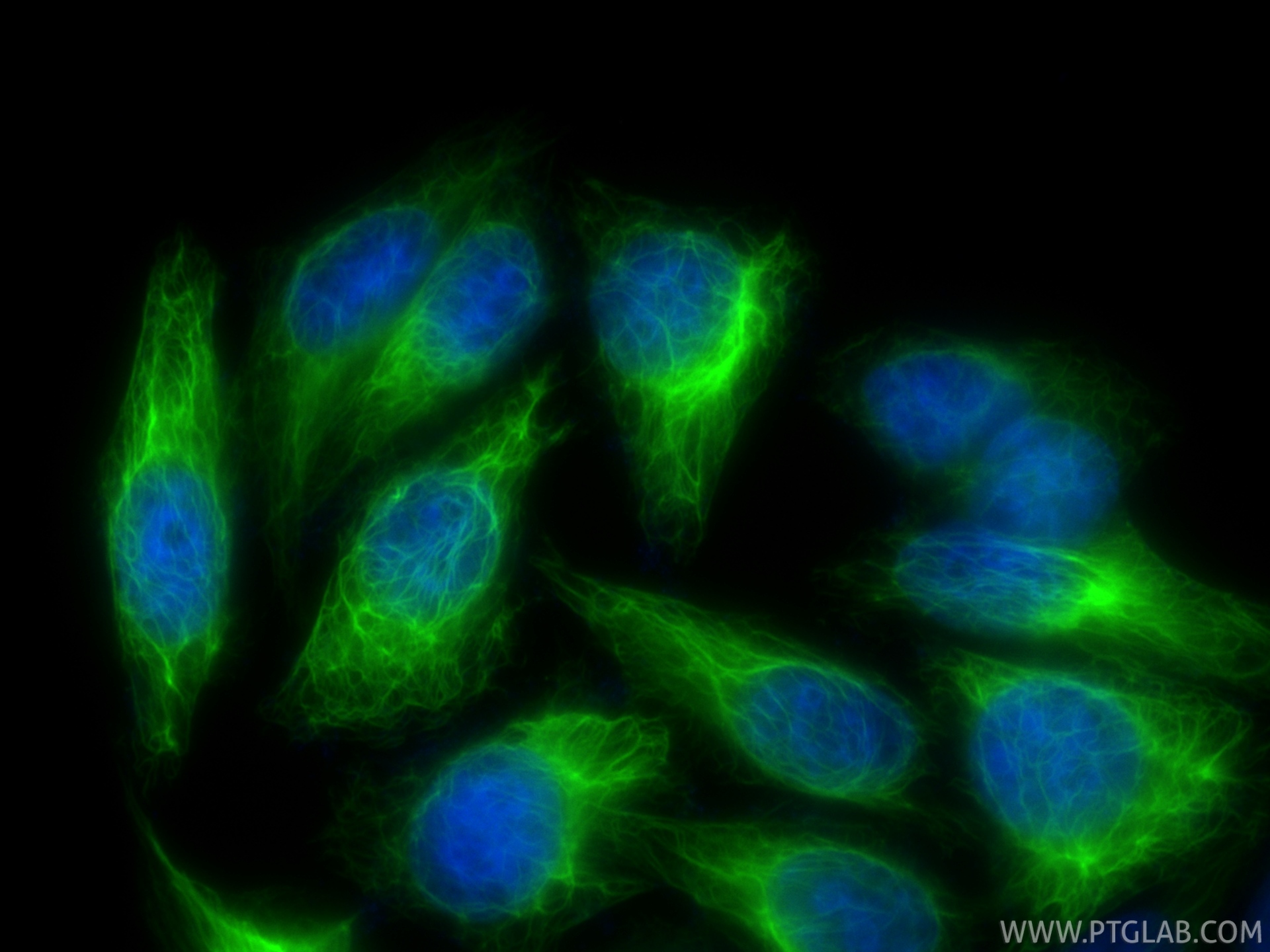 IF Staining of HepG2 using CL488-86153-7 IF Staining of HepG2 using CL488-86153-7