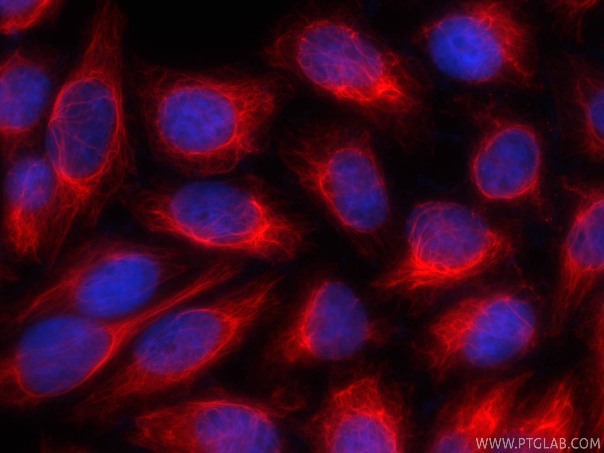 IF Staining of HepG2 using CL594-86153-7