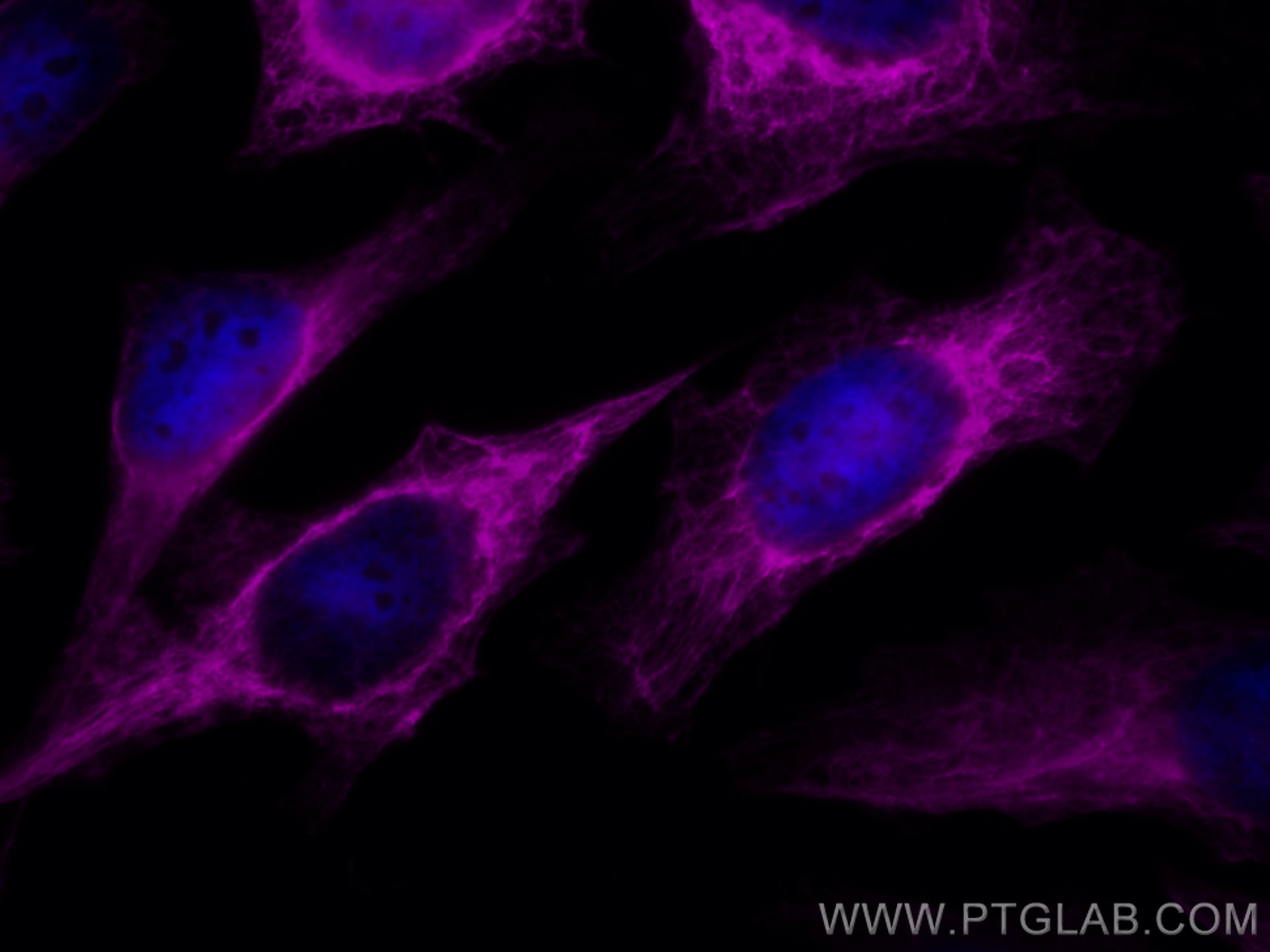 IF Staining of HeLa using CL647-22208