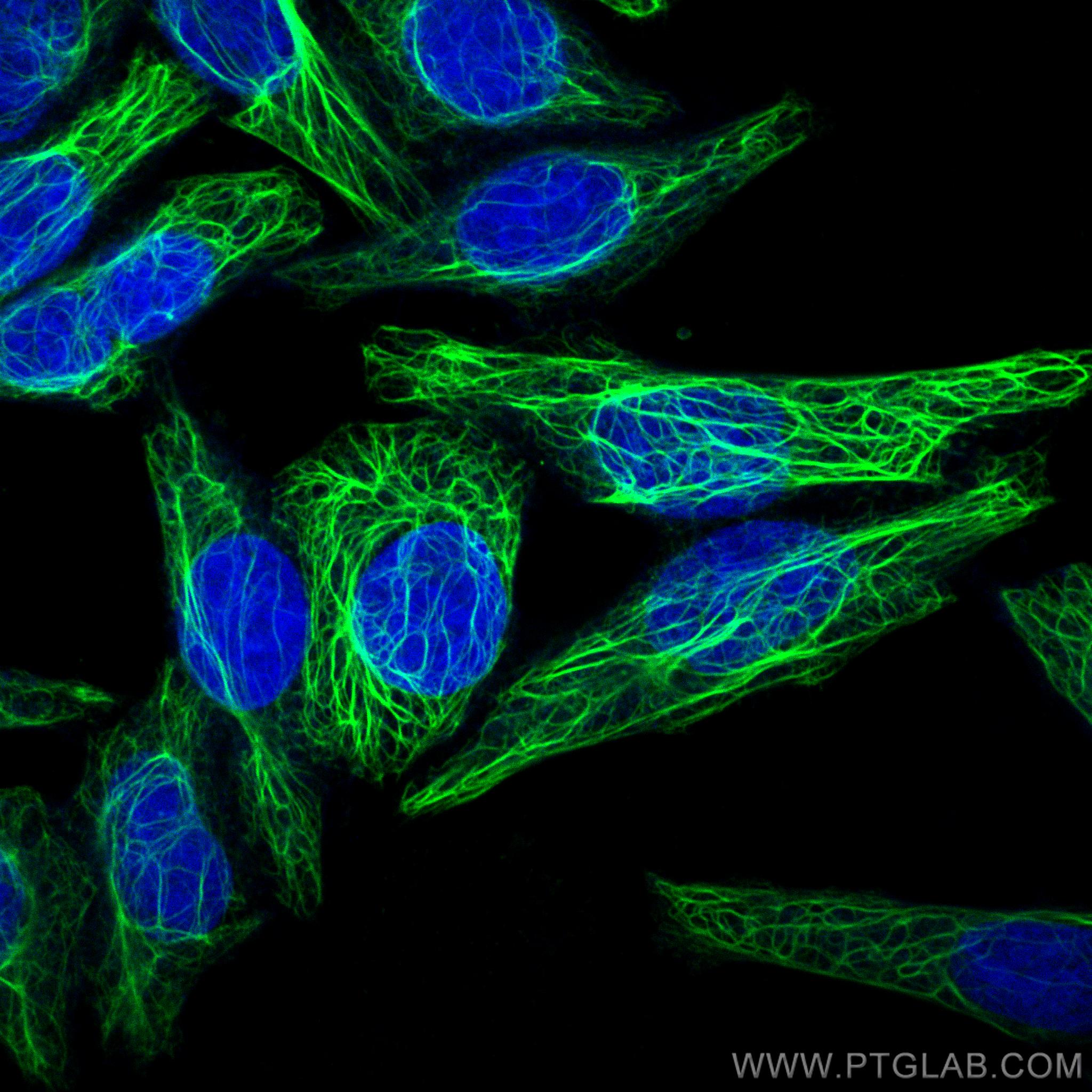 Cytokeratin 7-specific