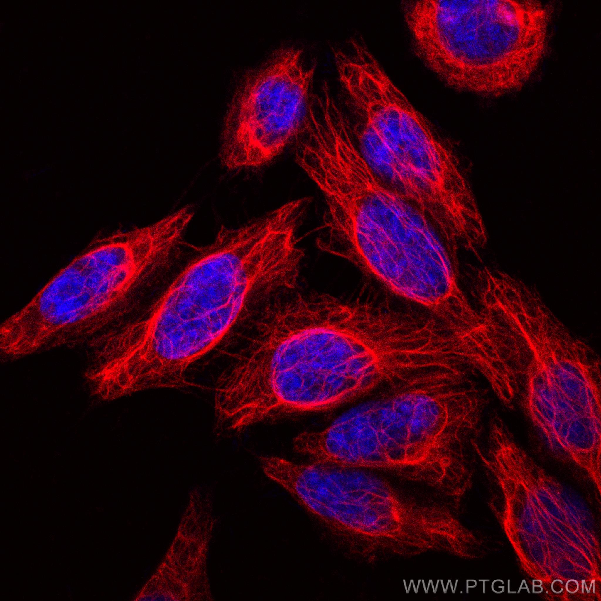 Cytokeratin 7-specific