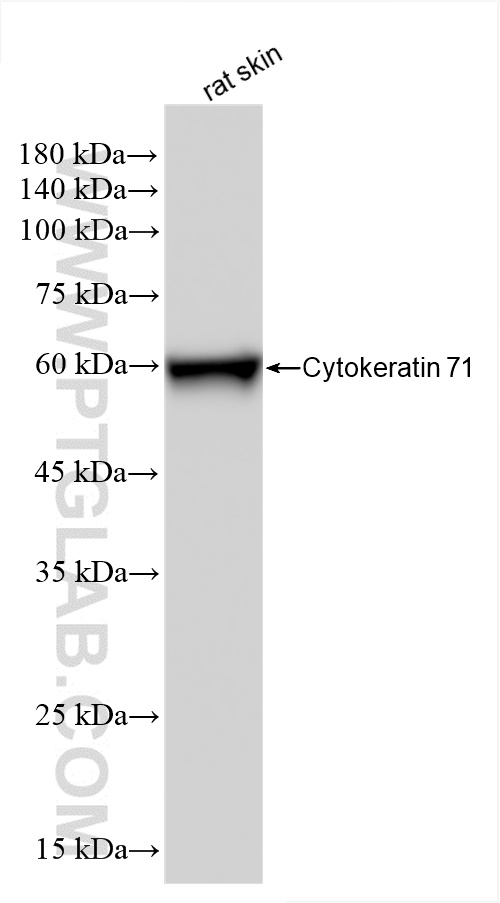 WB analysis of rat skin using 86352-1-RR