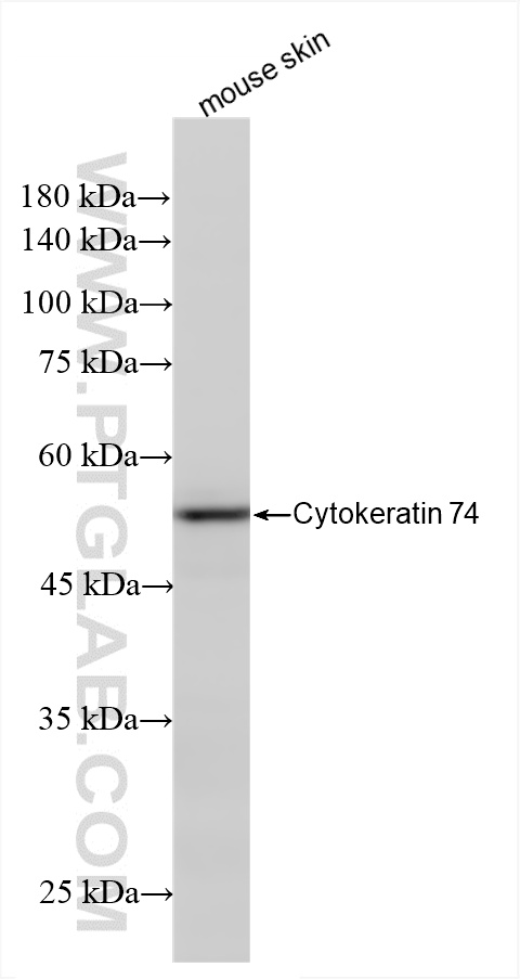 WB analysis of mouse skin using 86325-2-RR