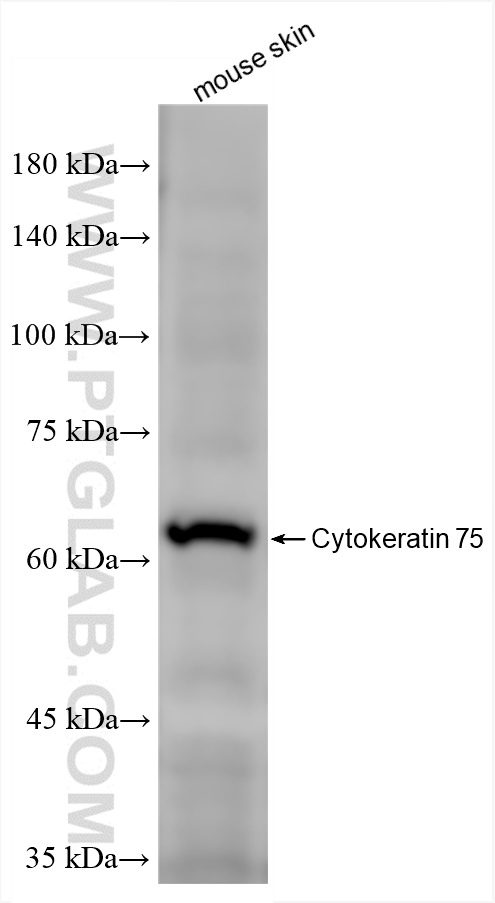 WB analysis of mouse skin using 86382-1-RR
