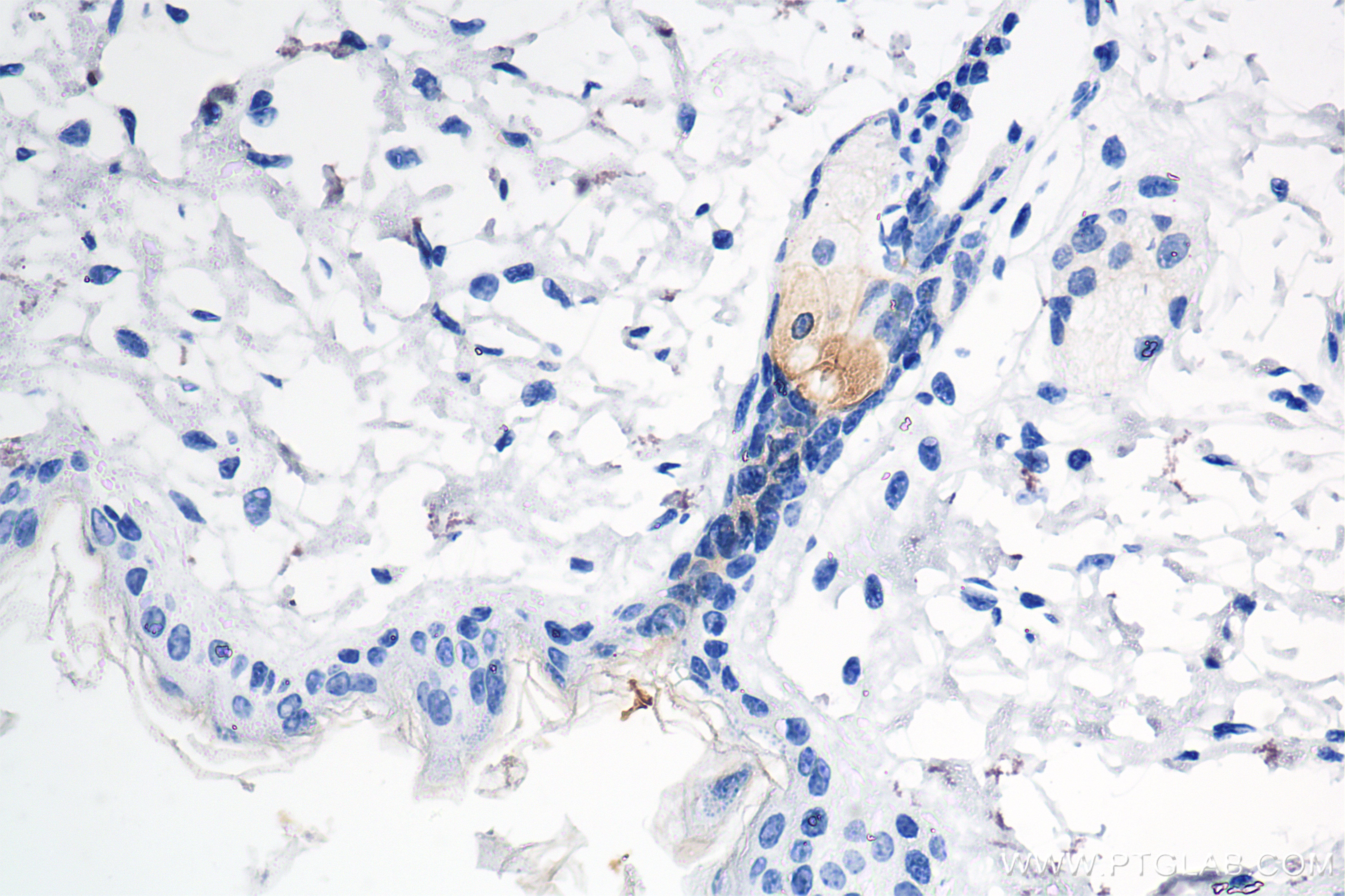 IHC staining of mouse skin using 86310-1-RR