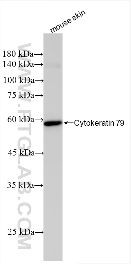 WB analysis of mouse skin using 86310-1-RR