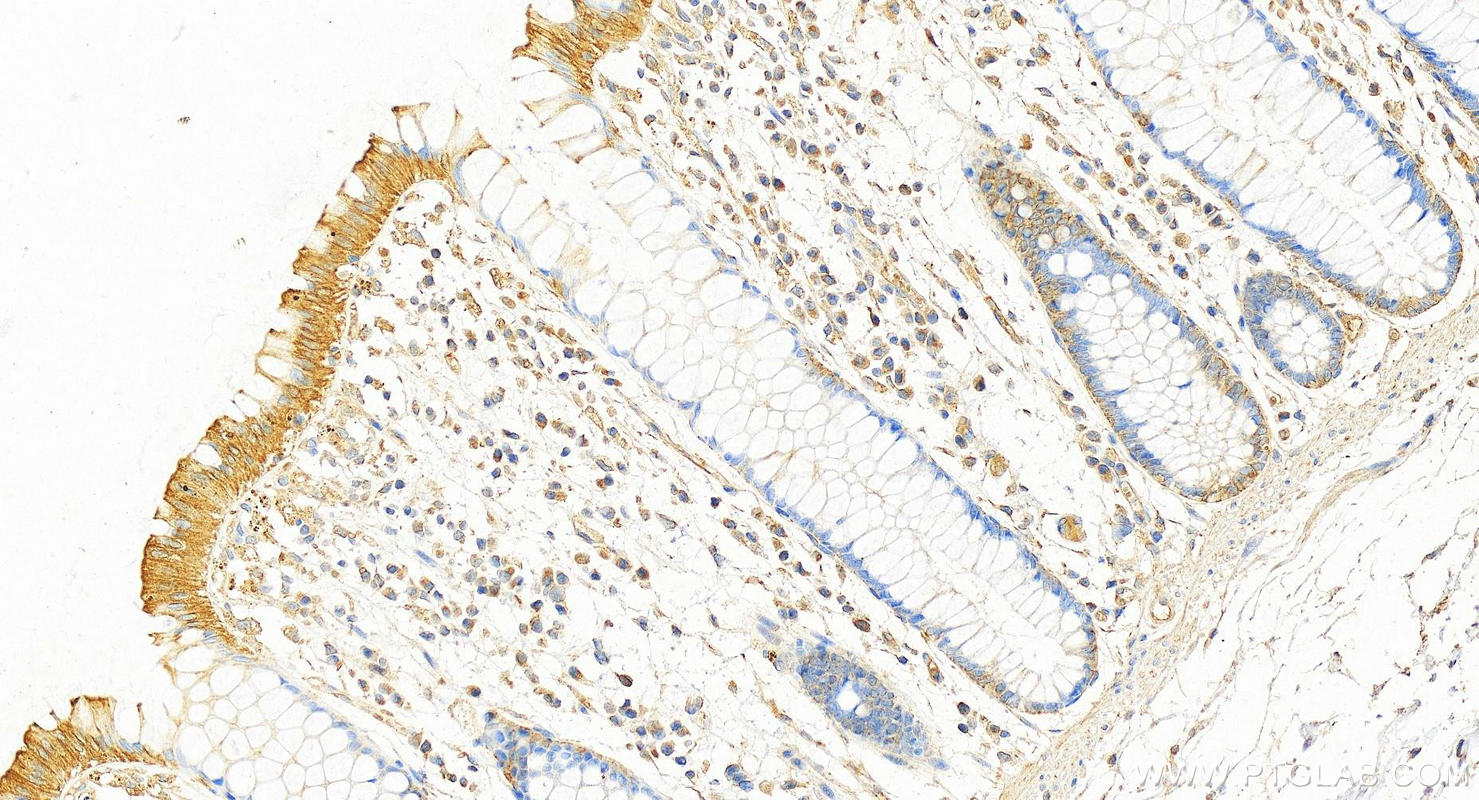 IHC staining of human colon using 68627-1-Ig