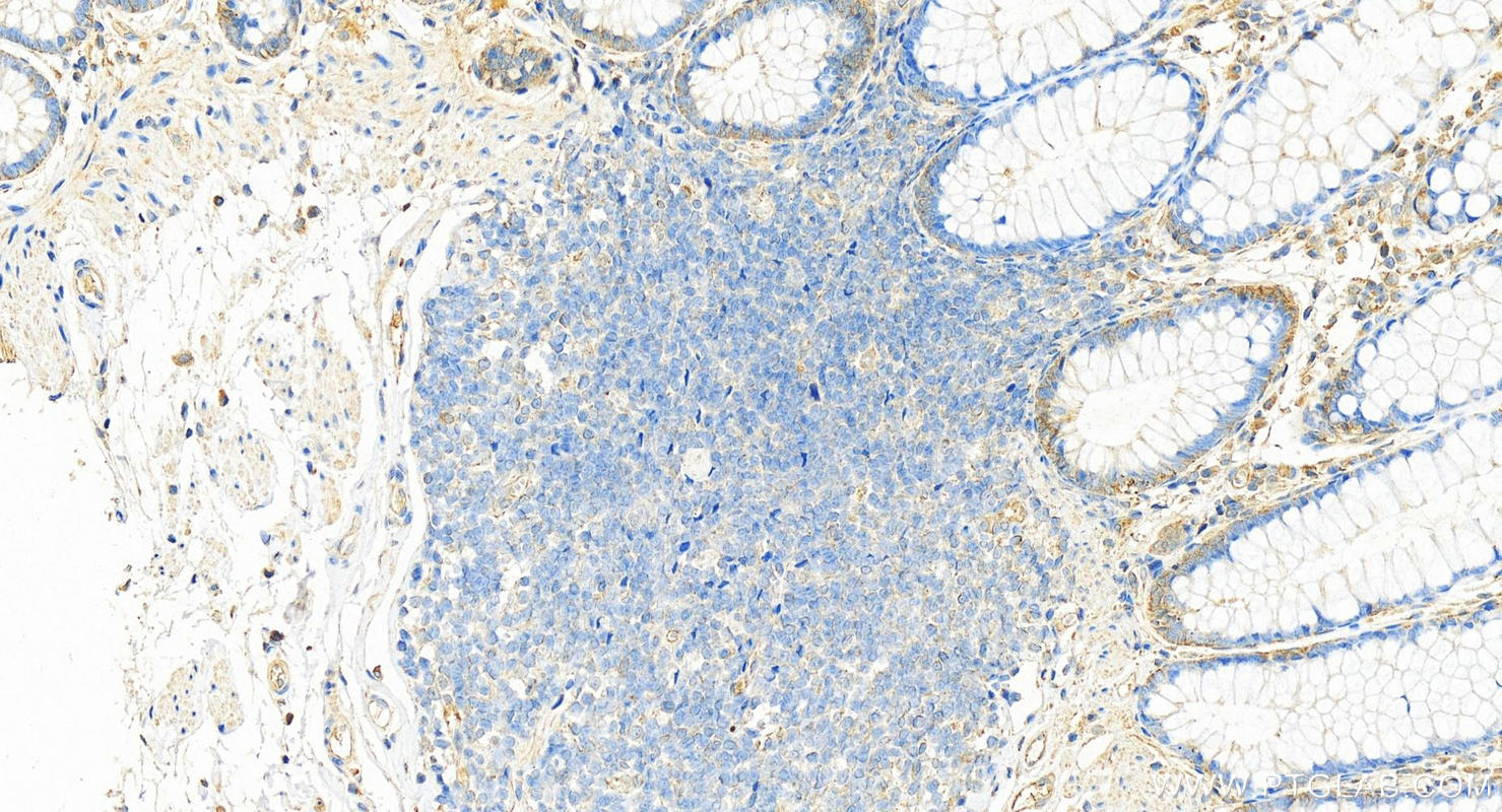 IHC staining of human colon using 68627-1-Ig