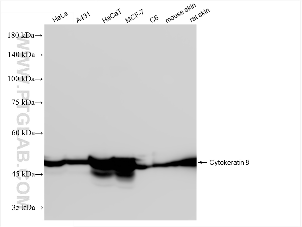 Various lysates were subjected to SDS PAGE followed by western blot with <a class='green' href='/productredirect?CatalogNo=86457-4-RR' target='_blank'>86457-4-RR</a> (Cytokeratin 8 antibody) at dilution of 1:10000 incubated at room temperature for 1.5 hours. This data was developed using the same antibody clone with 86457-4-PBS in a different storage buffer formulation. WB analysis using 86457-4-RR (same clone as 86457-4-PBS)