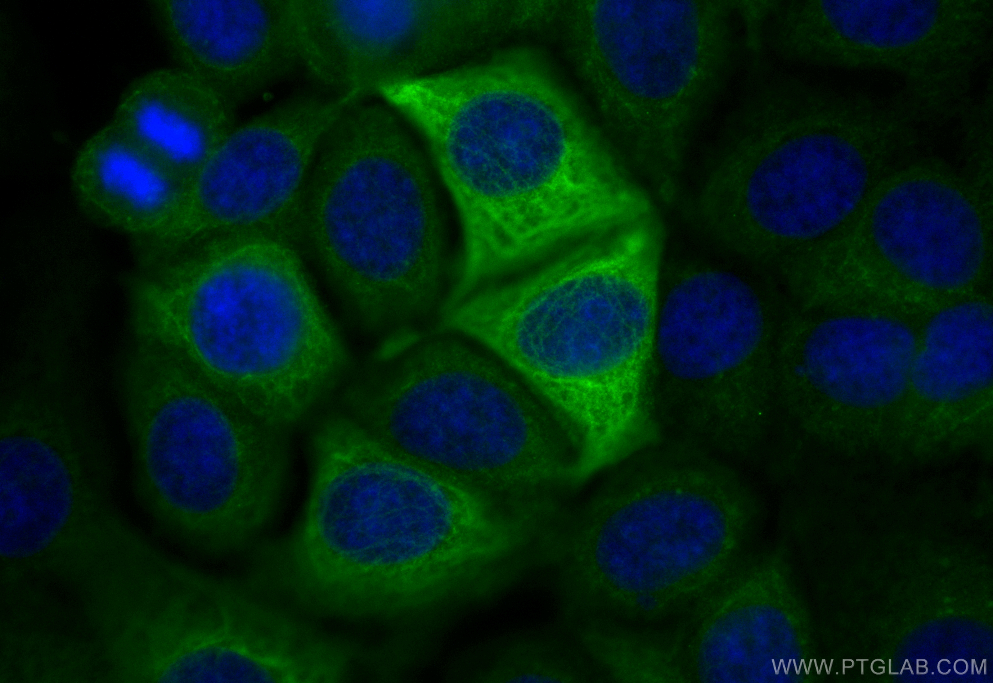IF Staining of MCF-7 using CL488-10384