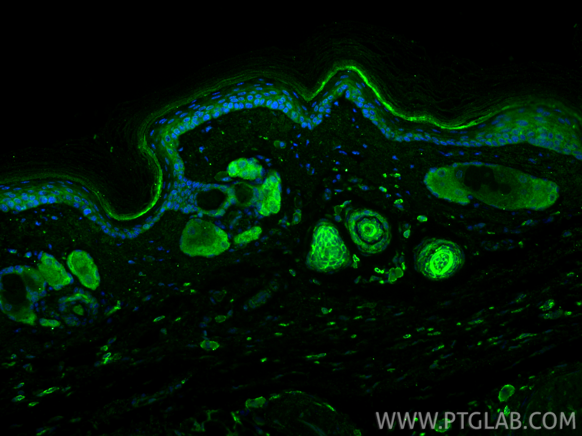 IF Staining of mouse skin using 86313-1-RR