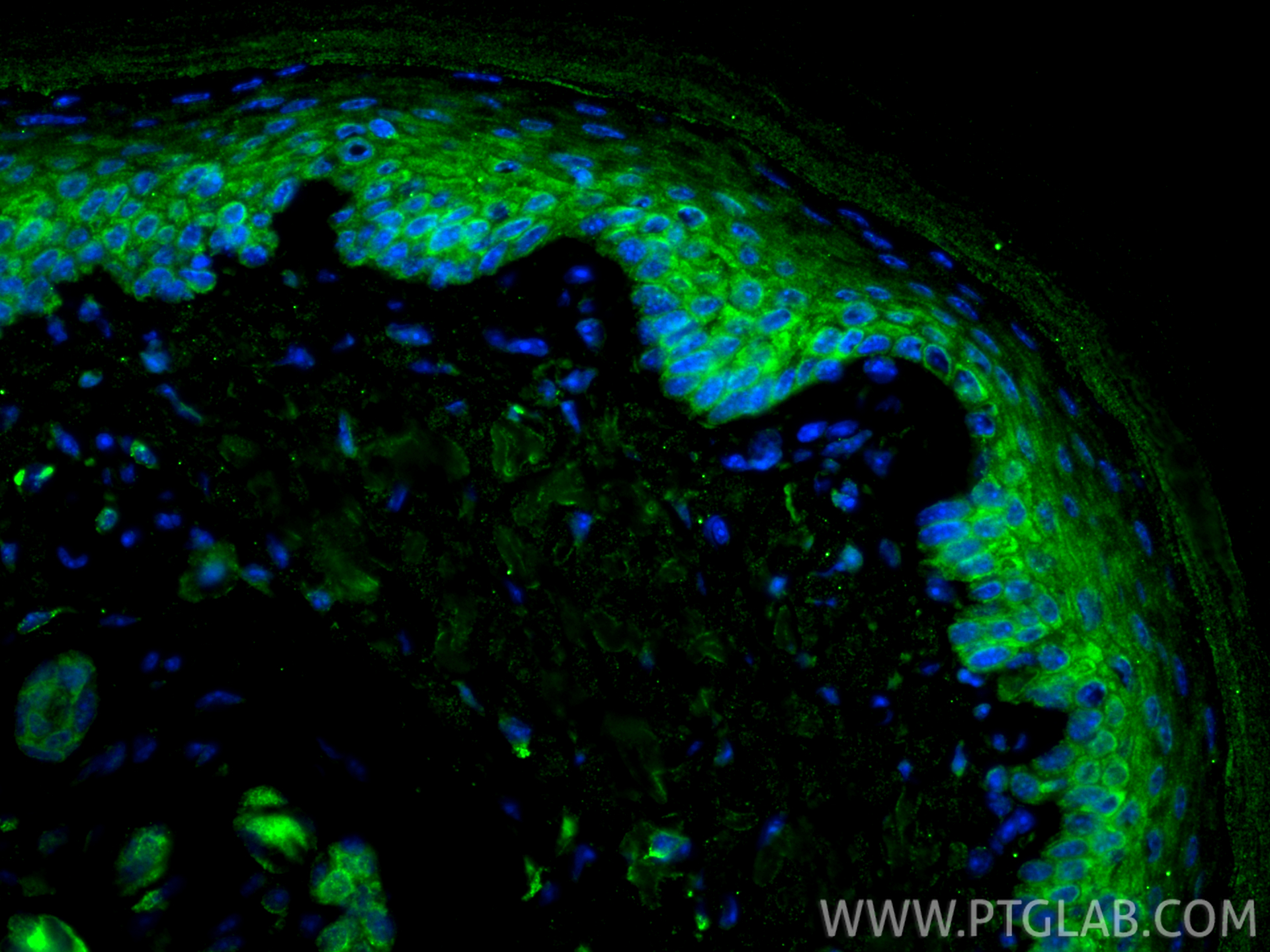 IF Staining of mouse skin using 86313-1-RR