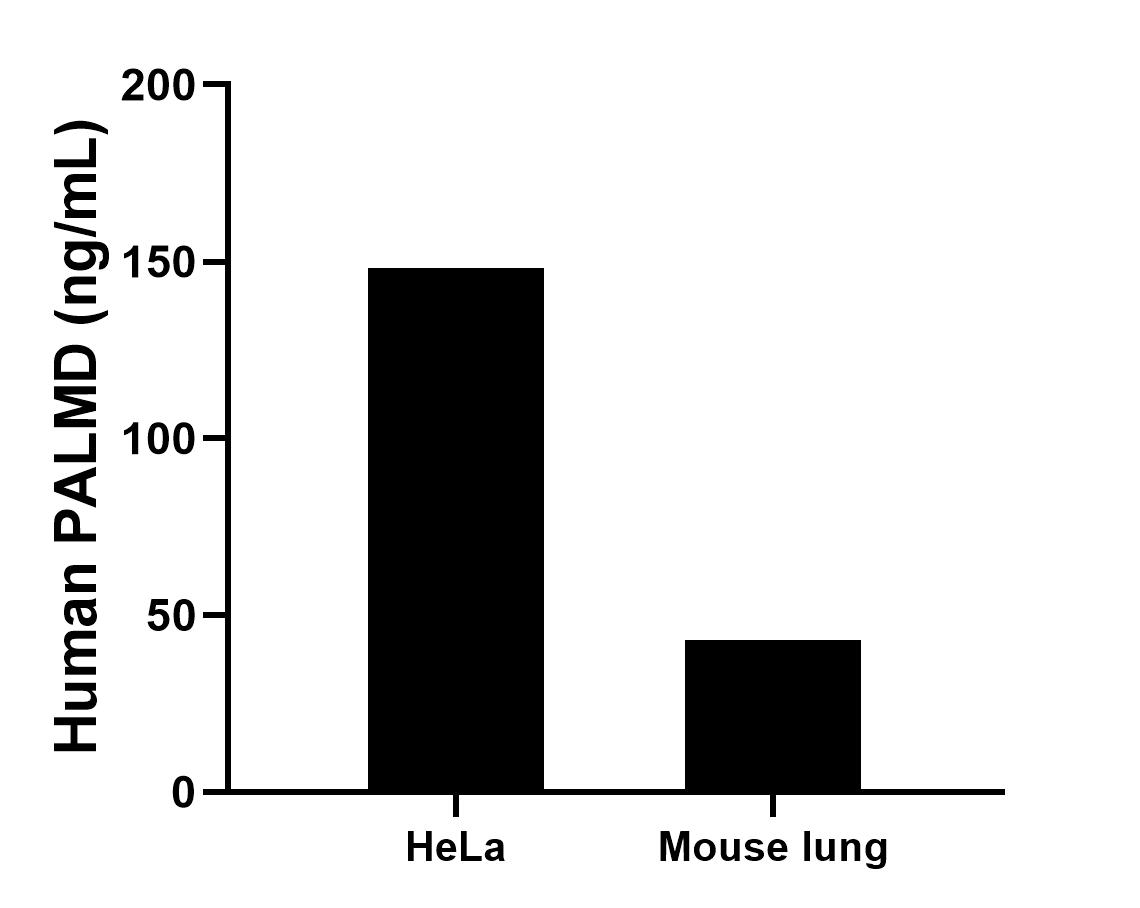 The mean PALMD concentration was determined to be 148.3 ng/mL in HeLa cell extract based on a 1.2 mg/mL extract load, 42.8 ng/mL in Mouse lung tissue extract based on a 5.0 mg/mL extract load. Cytometric bead array sample test of MP02954-1