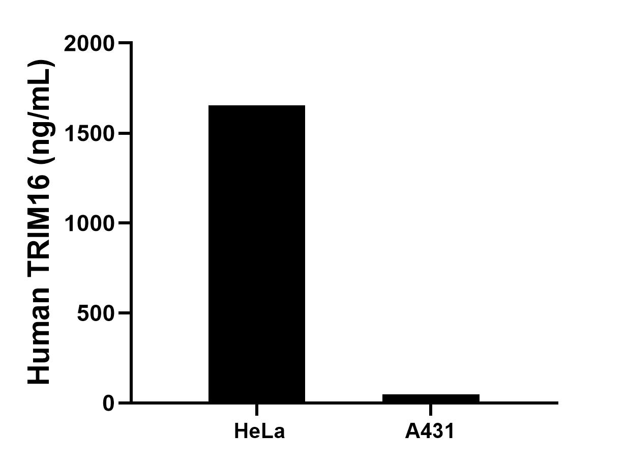 Cytometric bead array sample test of MP02988-1
