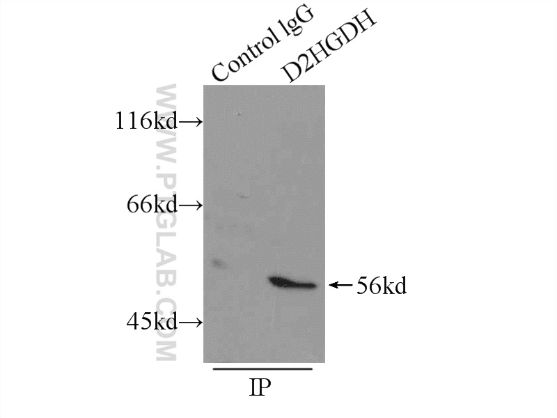 IP experiment of mouse liver using 13895-1-AP