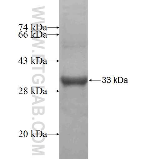D2HGDH fusion protein Ag5036 SDS-PAGE