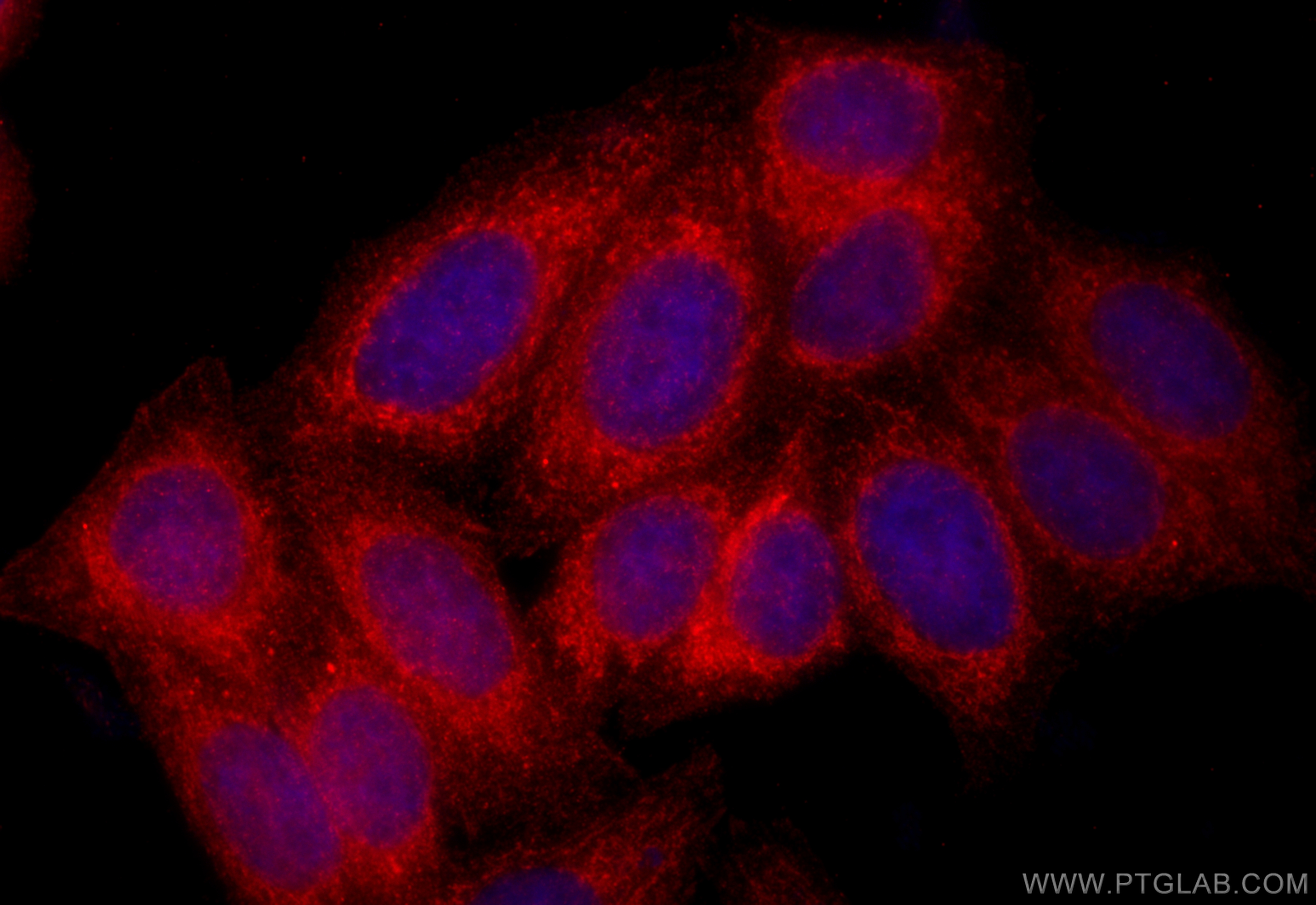 IF Staining of HepG2 using 14876-1-AP IF Staining of HepG2 using 14876-1-AP