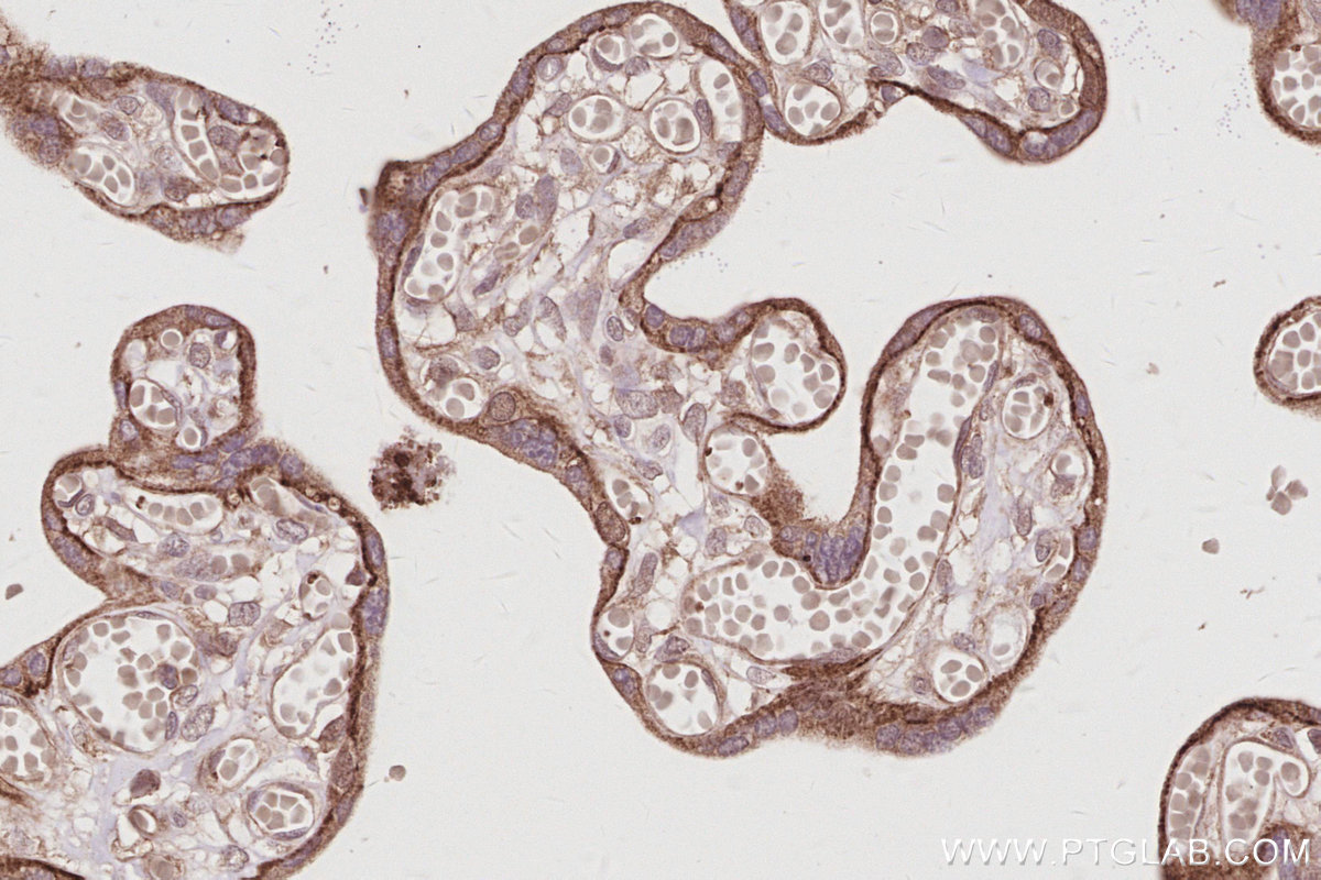 IHC staining of human placenta using 14876-1-AP IHC staining of human placenta using 14876-1-AP