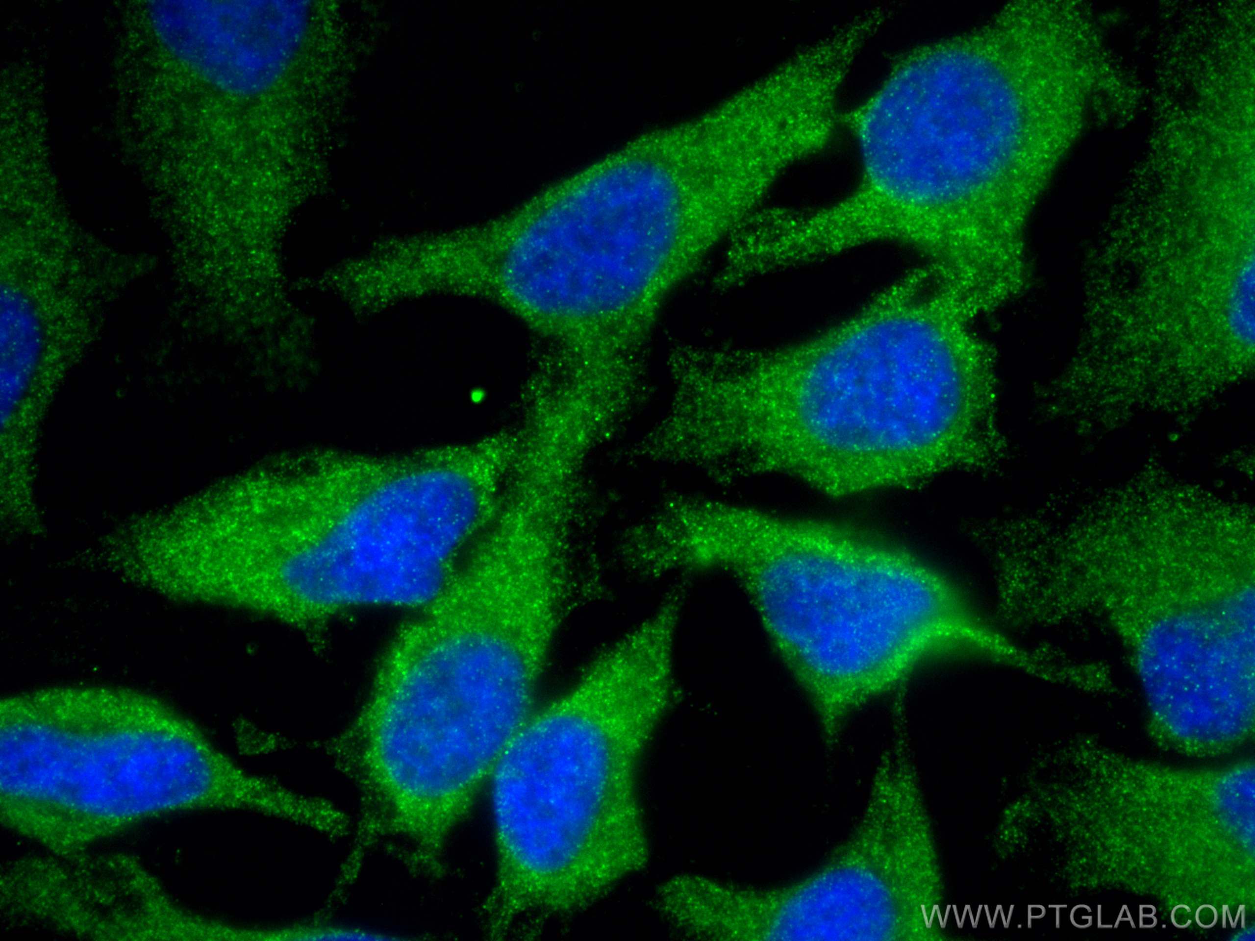 IF Staining of HeLa using 25206-1-AP