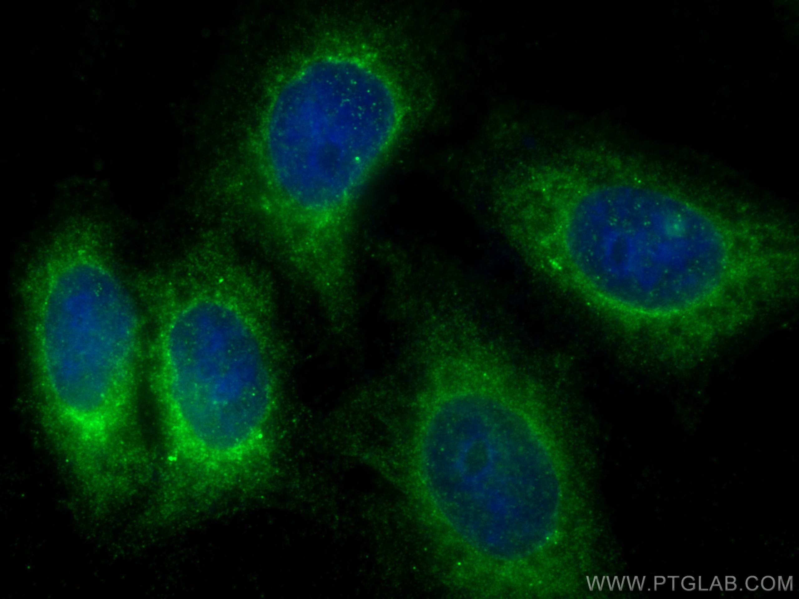 IF Staining of HepG2 using 31459-1-AP