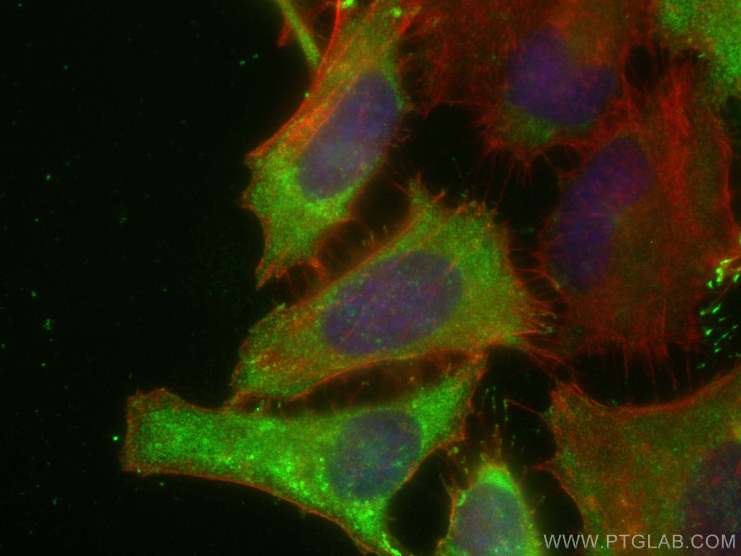 IF Staining of HeLa using 10109-2-AP