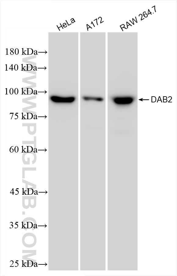 WB analysis using 86141-1-RR (same clone as 86141-1-PBS)
