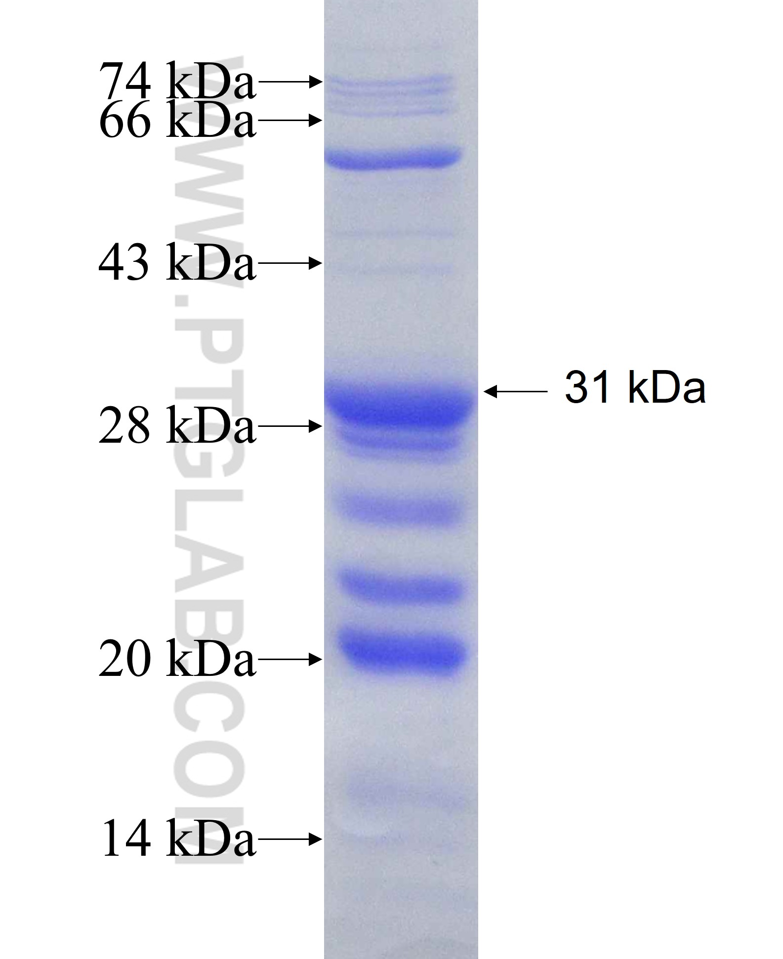 DAB2 fusion protein Ag27192 SDS-PAGE