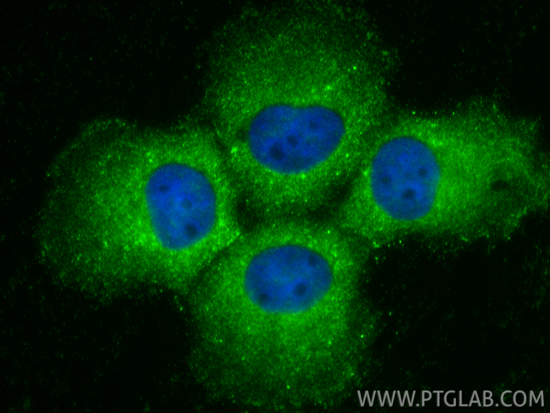 IF Staining of A431 using 23582-1-AP IF Staining of A431 using 23582-1-AP