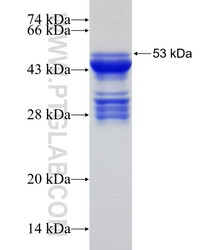 DAB2IP fusion protein Ag31340 SDS-PAGE
