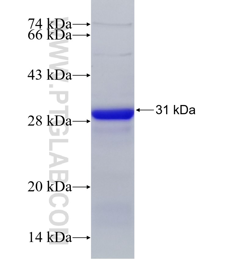 DAB2IP fusion protein Ag31354 SDS-PAGE DAB2IP fusion protein Ag31354 SDS-PAGE
