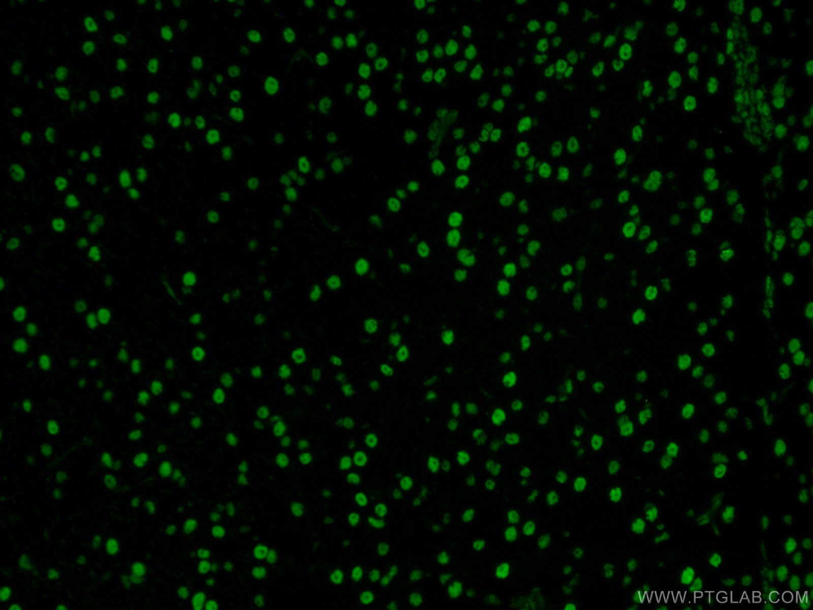 IF Staining of mouse brain using 60082-1-Ig (same clone as 60082-1-PBS)