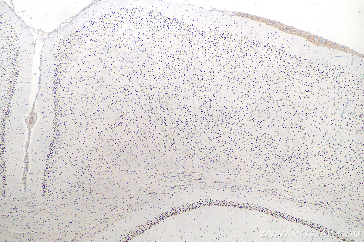 IHC staining of rat brain using 60082-1-Ig